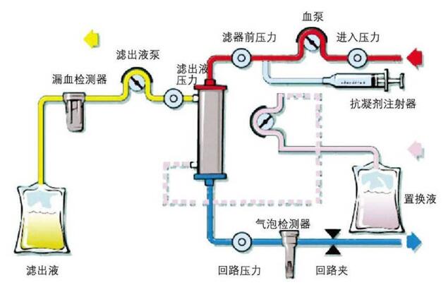 血液透析